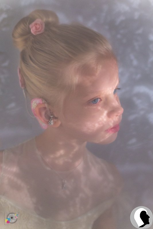 CI Kopf 2018 weiblich Kind